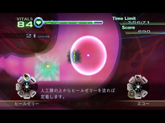 Скриншот из игры Trauma Center: New Blood