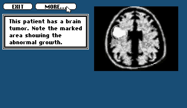 Скриншот из игры Life & Death 2: The Brain